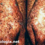 xeroderma pigmentoso